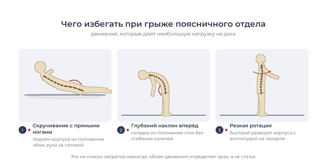 Движения, которых стоит избегать при грыже поясничного отдела